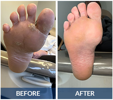 swift before and after