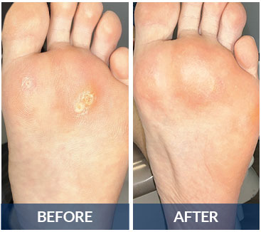 swift before and after
