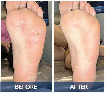 swift before and after