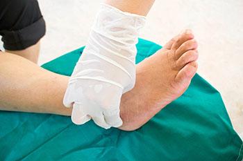 tarsal tunnel syndrome